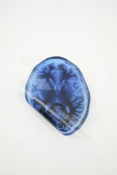 MICHAEL VICKERS | ARTIST PORTRAIT 1 (MRI/MEG) | IMPRESSION PIGMENTAIRE D'ARCHIVES SUR MYLAR TRANSPARENT  | 13 X 17 POUCES | 2017