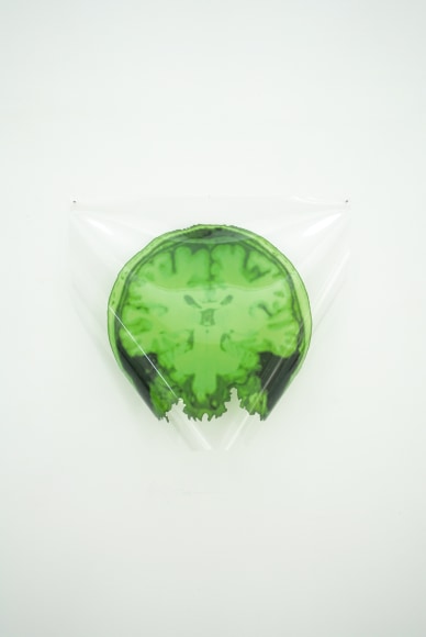 MICHAEL VICKERS | ARTIST PORTRAIT 3 (MRI/MEG) | IMPRESSION PIGMENTAIRE D'ARCHIVES SUR MYLAR TRANSPARENT  | 13 X 17 POUCES | 2017