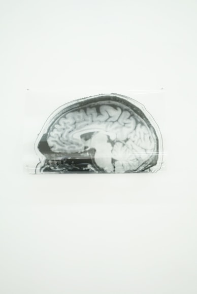 MICHAEL VICKERS | ARTIST PORTRAIT 2 (MRI/MEG) | IMPRESSION PIGMENTAIRE D'ARCHIVES SUR MYLAR TRANSPARENT  | 13 X 17 POUCES | 2017