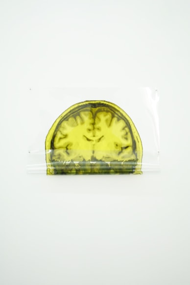 MICHAEL VICKERS | ARTIST PORTRAIT 5 (MRI/MEG) | IMPRESSION PIGMENTAIRE D'ARCHIVES SUR MYLAR TRANSPARENT  | 13 X 17 POUCES | 2017