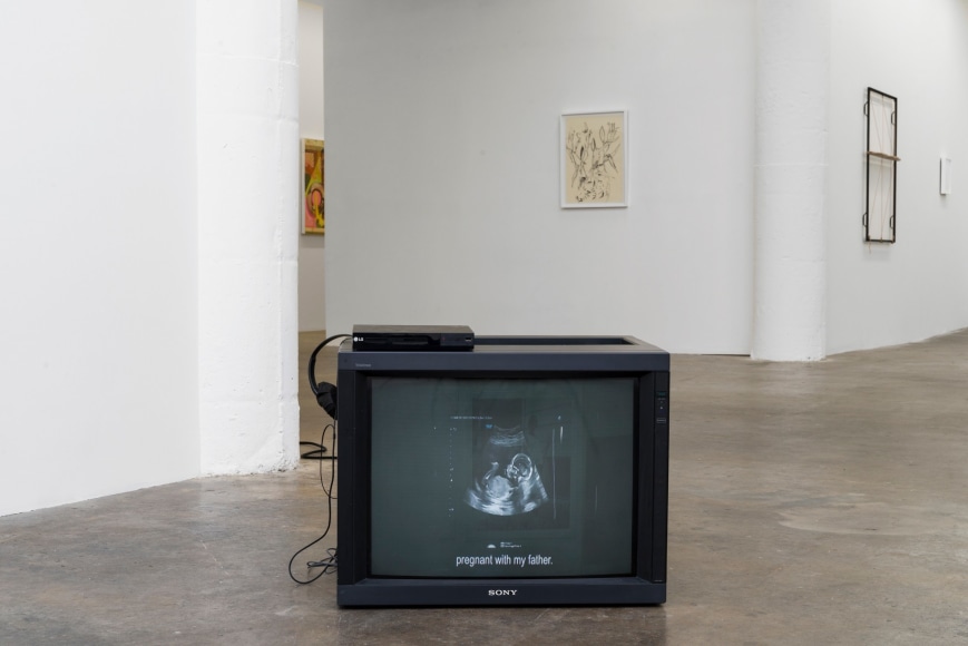 Cristine Brache Morning Sickness in the U.S.A., 2020.