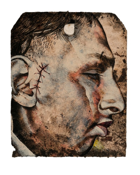 Stotik - man with stitched ear