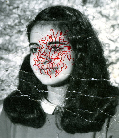 Os pari&eacute;tal, f&oelig;tus de 5 mois, 2012 - What Cannot Be Seen | Carolle Benitah Fine Art Prints