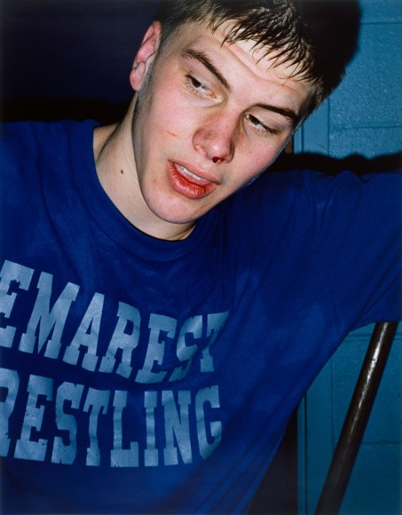 Collier Schorr, Bloody Nose