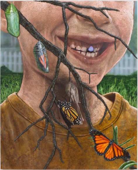 Painting of a boy with a loose tooth