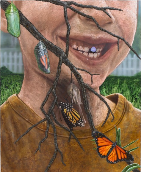 Loose tooth with butterfly and cocoon