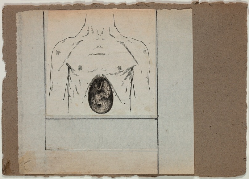 Robert Rauschenberg,&nbsp;Untitled [chest and cavity], c. 1952.