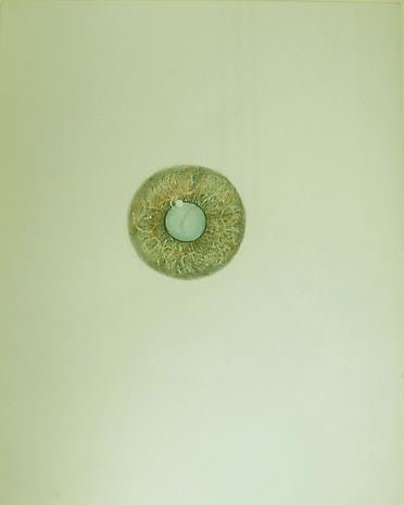 COLTER JACOBSEN Cone Cataract IV