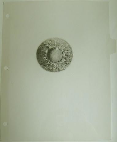 COLTER JACOBSEN Cone Cataract I