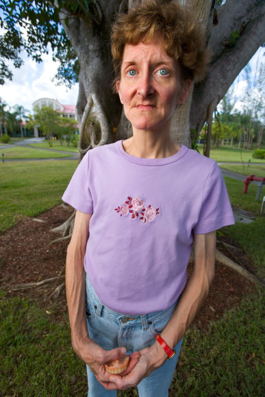 Kathy, 48, Lost Her Teeth Due to Malnutrition, Coconut Creek Florida, 2005, Archival Pigment Print