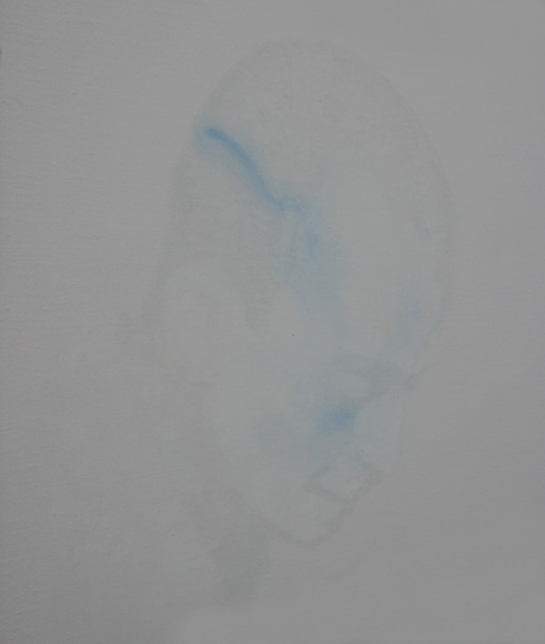 Sorrow in Part 局部忧伤