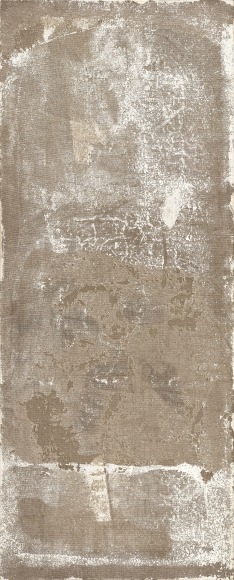 Cataract No.3 白内障 No.3