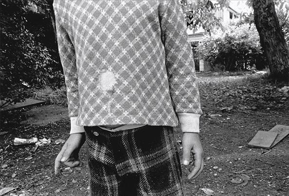 Hole in Shirt, 1974, 	16 x 20 inch gelatin silver print