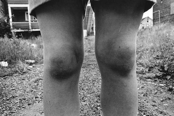 Dark Knees, 1974, 	16 x 20 inch gelatin silver print