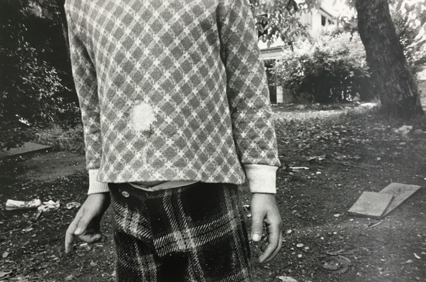 Mark Cohen , Hole in Shirt. 1974