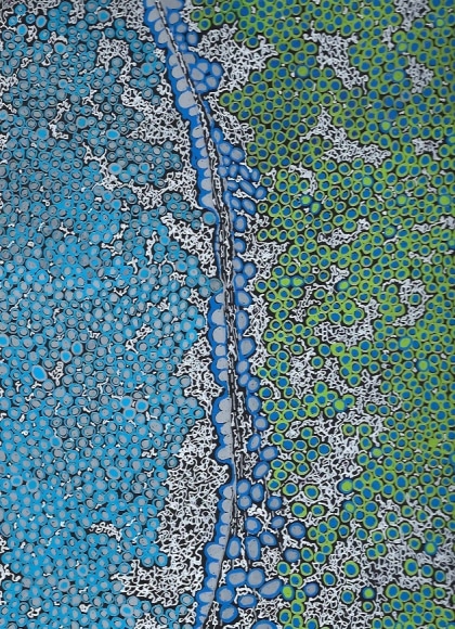 Jody Rasch, Healing 3 - Blood Clot