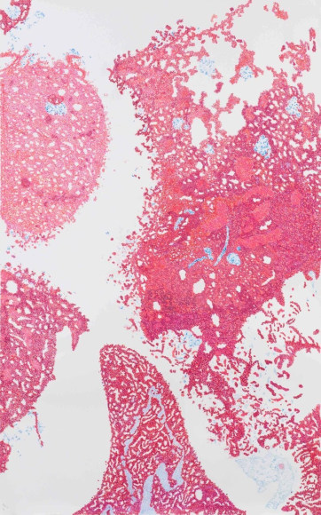 Jody Rasch, Corona Virus