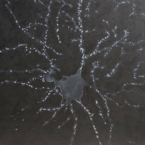 Jody Rasch, Loss - Alzheimers