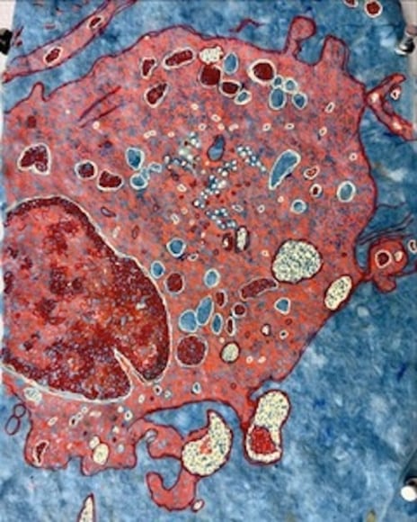 Jody Rasch, Healing - White Blood Cell 4