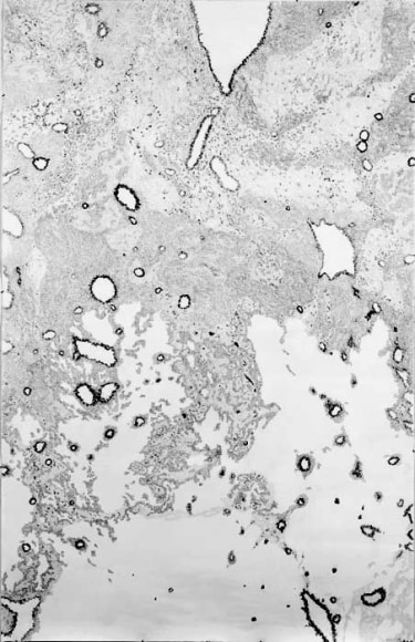 Jody Rasch, Background