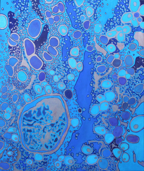 Jody Rasch, Sweet - Diabetes