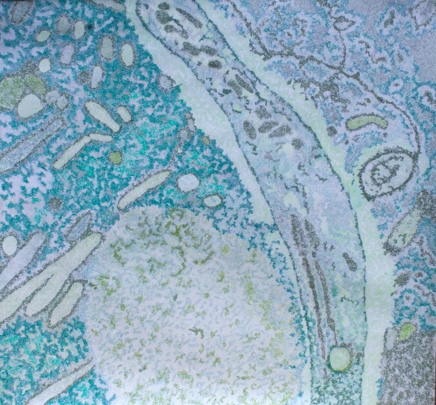 Jody Rasch, Plasmodium (Malaria)