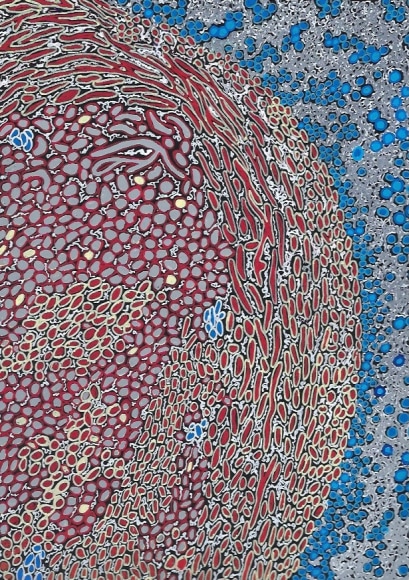 Jody Rasch,  Healing 1- Blood Clot