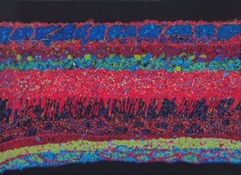 Jody Rasch, Sight - Retina