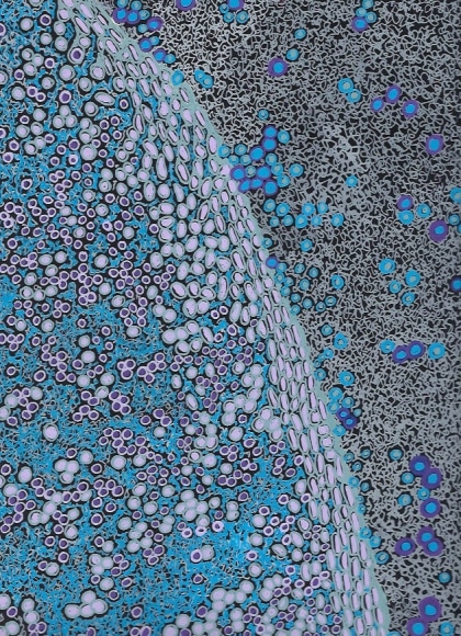 Jody Rasch, Healing 2 - Blood Clot