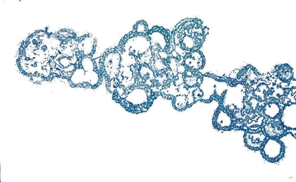 Jody Rasch, Possibilities - Stem Cells