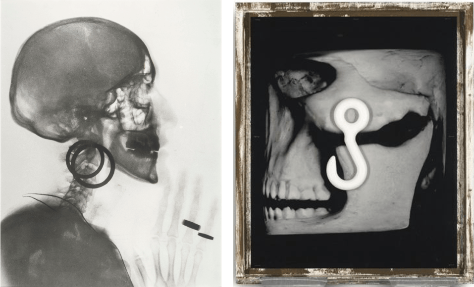 Meret Oppenheim, X-Ray, 1964