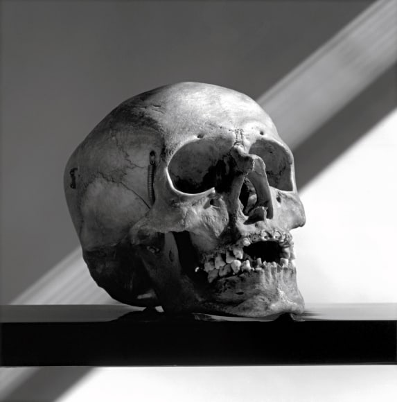 Skull in 3/4 view.