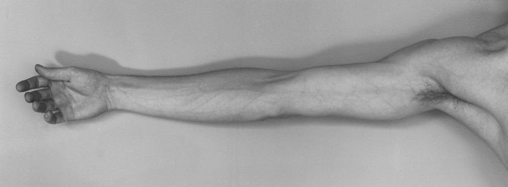 Self-Portrait of the artist&rsquo;s arm outstretched.