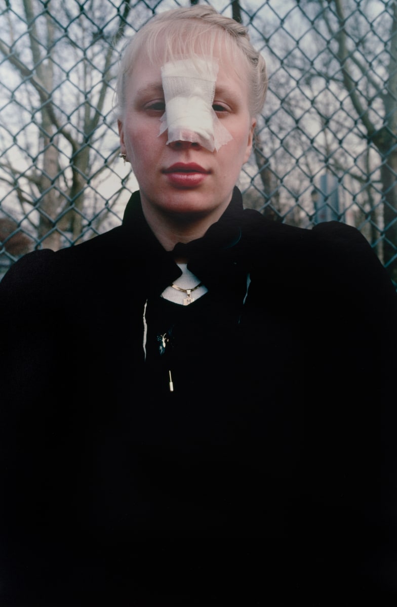 Arlene Gottfried Woman With Bandages, 1980&#039;s