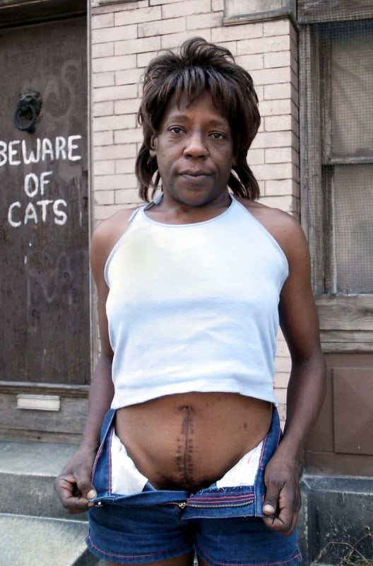 Zoe Strauss -
Victoria's Hysterectomy, 2001-2006 | Bruce Silverstein Gallery