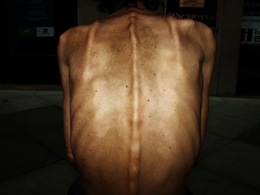 Zoe Strauss -
Man's Back, 2001-2006 | Bruce Silverstein Gallery