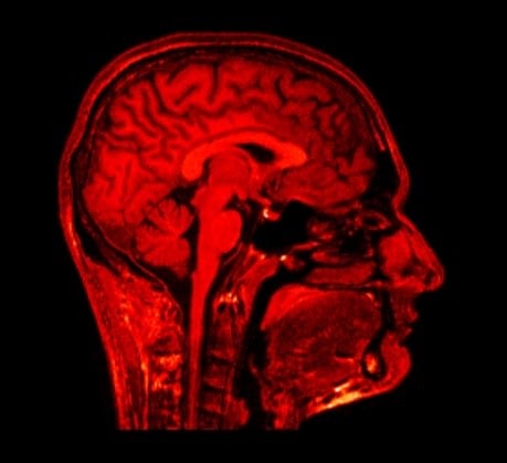 Simon Tegala WHATEVER HAPPENED TO EVERYTHING YOU BELIEVE IN 2007 MRI animation Duration: 1min, 19sec