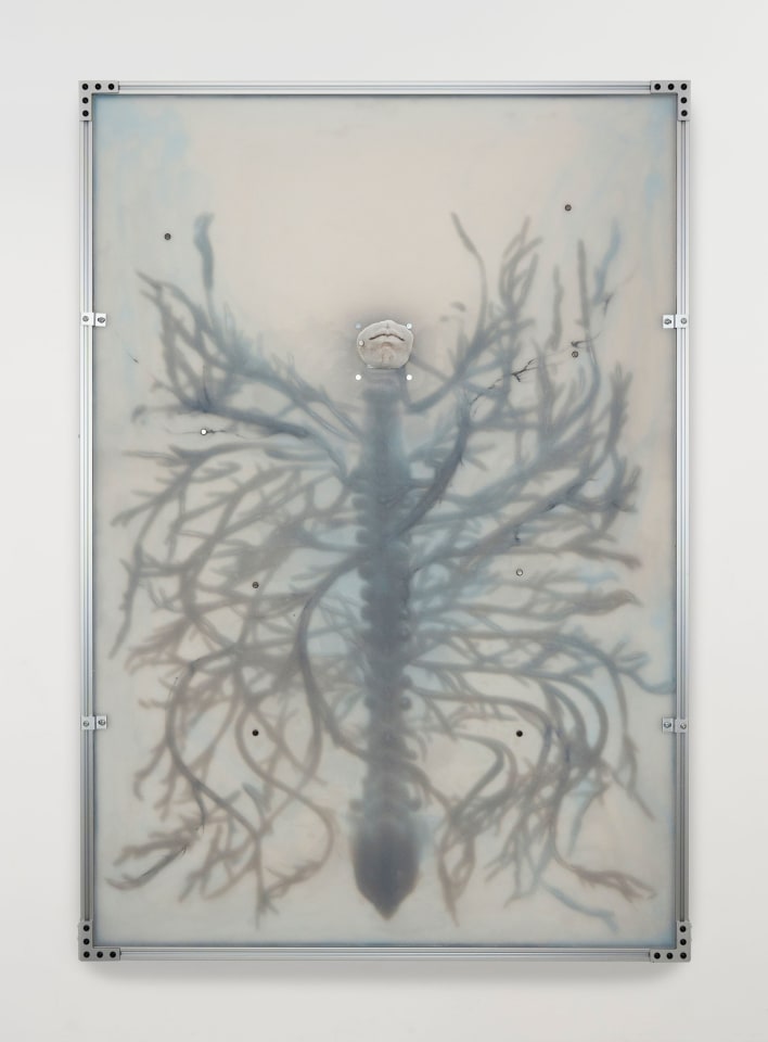 Xin Liu, Overgrowth, 2025