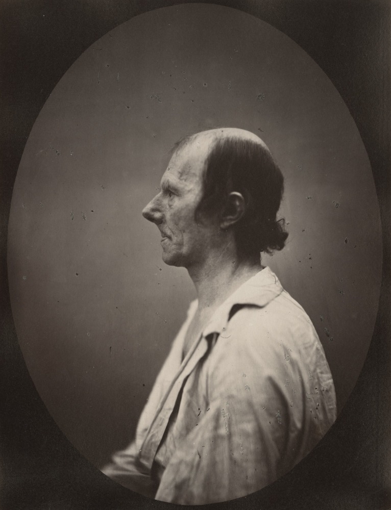 DUCHENNE DE BOULOGNE and Adrien TOURNACHON (French, 1806-1875 &amp; 1825-1903) Portrait of the old man in profile*, 1862, negative, circa 1856 Albumen print from a glass negative 22.1 x 16.5 cm oval on 22.8 x 17.5 cm paper