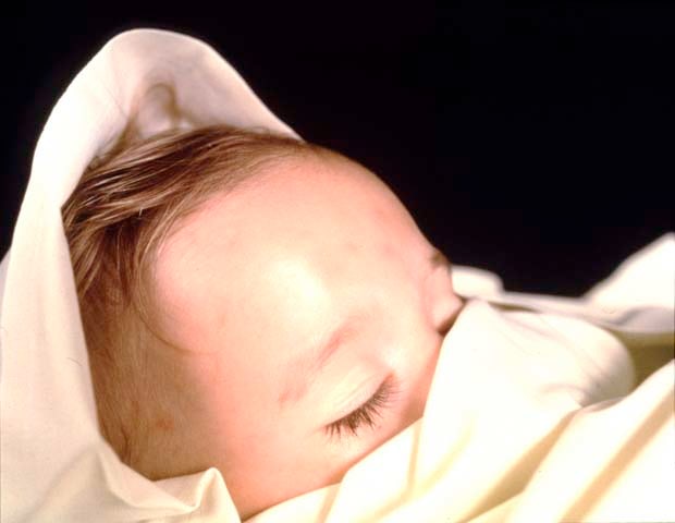 Andres Serrano &quot;The Morgue (Fatal Meningitis II)&quot; 1992 Cibachrome, silicone, plexi-glass, wood frame 49 1/2&quot; x 60&quot;