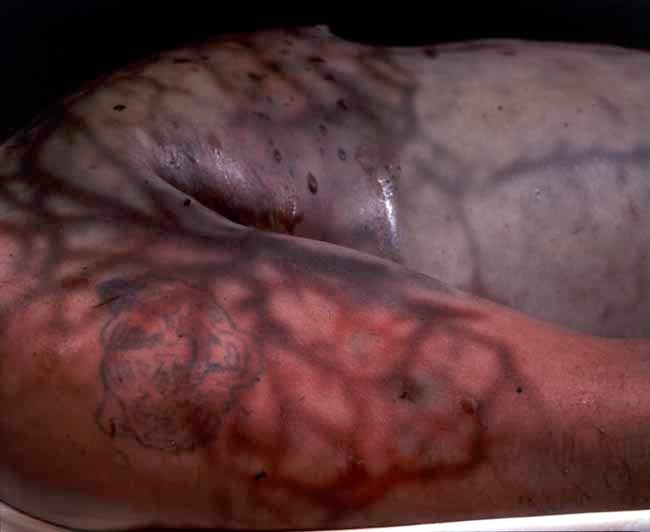 Andres Serrano &quot;The Morgue (Death by Drowining III)&quot; 1992 Cibachrome, silicone, plexi-glass, wood frame 49 1/2&quot; x 60&quot;