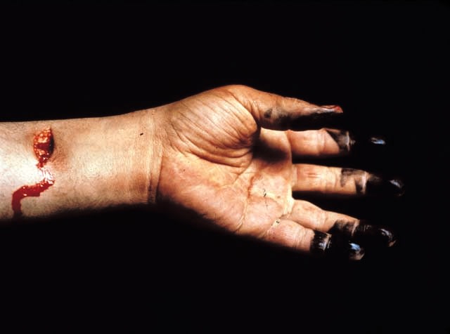 Andres Serrano &quot;The Morgue (Knifed to Death I)&quot; 1992 Cibachrome, silicone, plexi-glass, wood frame 49 1/2&quot; x 60&quot;