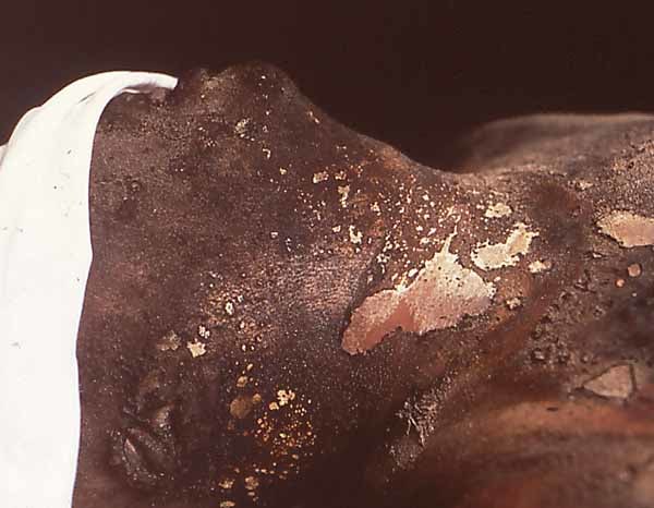 Andres Serrano &quot;The Morgue (Death by Fire II)&quot; 1992 Cibachrome, silicone, plexi-glass, wood frame 49 1/2&quot; x 60&quot;