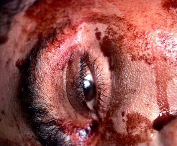 Andres Serrano &quot;The Morgue (Hacked to Death II)&quot; 1992 Cibachrome, silicone, plexi-glass, wood frame 49 1/2&quot; x 60&quot;