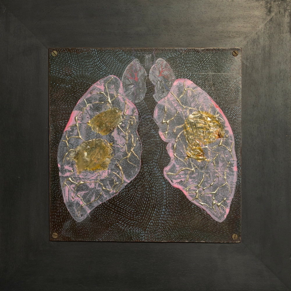 Lungs, 2010
Acrylic, silver powder and araldite on iron sheet
18" x 18"
TG 4893