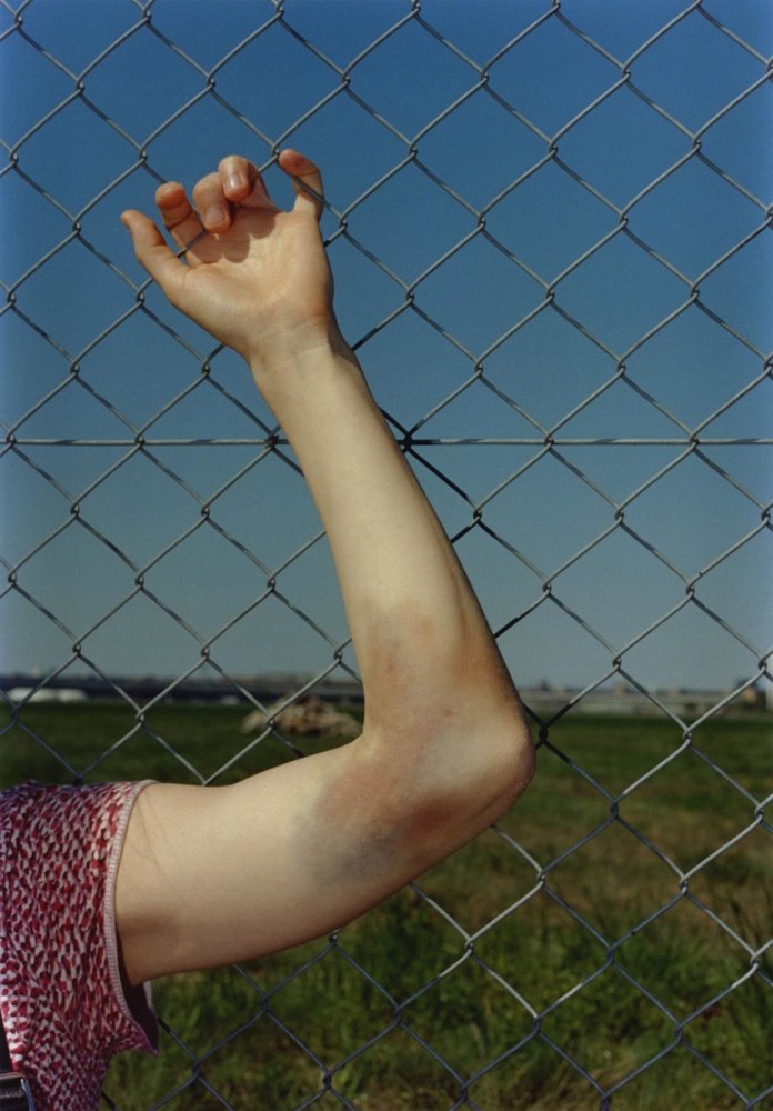 Annina bruise, 2020
hand-printed C-type print on archival photo paper, edition of 3 + 1AP
25.5 x 17.8 cm / 10 x 7 in&amp;nbsp;
