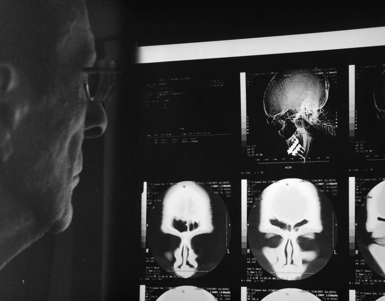 Leonard Nimoy (1931-2015)
Self Portrait with MRI, 2003 Ed. 3/25&amp;nbsp;&amp;nbsp;&amp;nbsp;
silver gelatin print
11 x 14 inches;&amp;nbsp;&amp;nbsp;27.9 x 35.6 centimeters
LSFA# 10362&amp;nbsp;