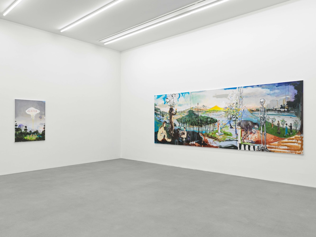 installation view