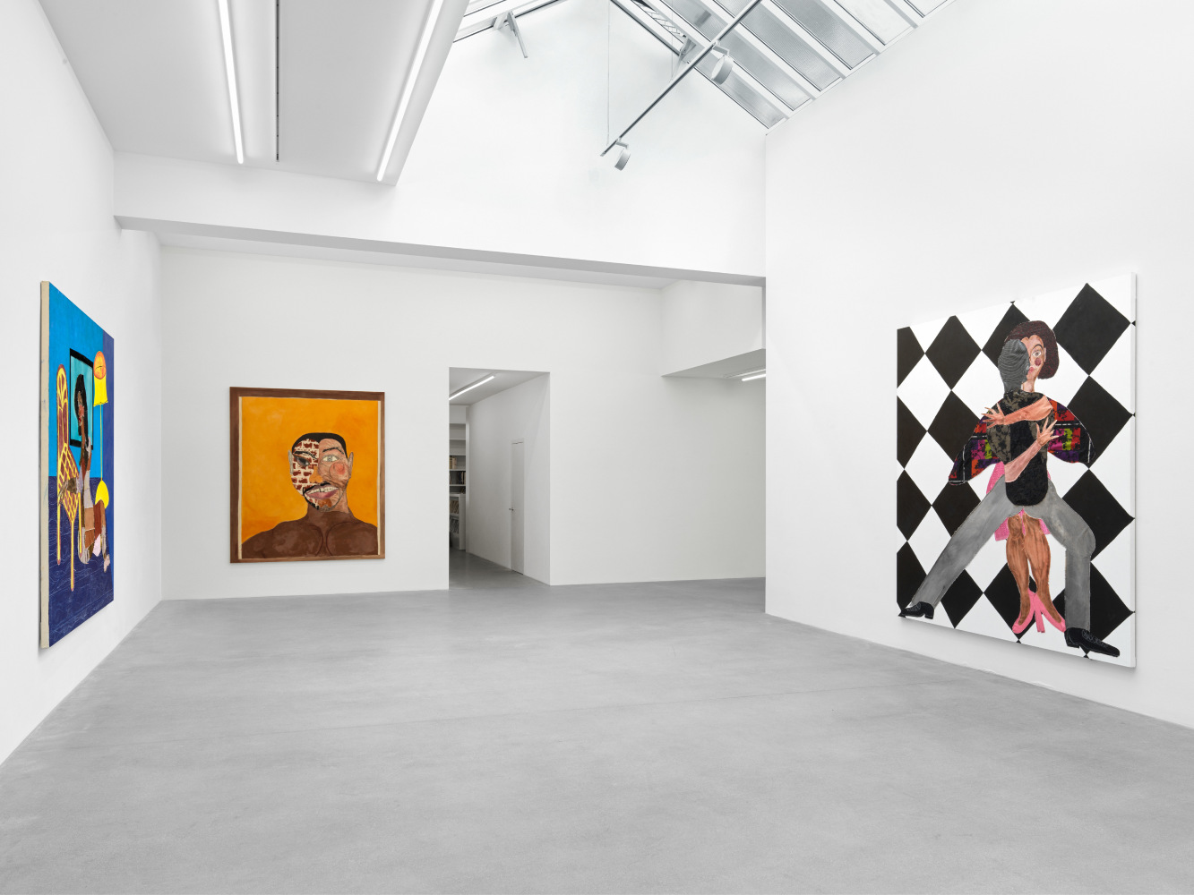 installation view