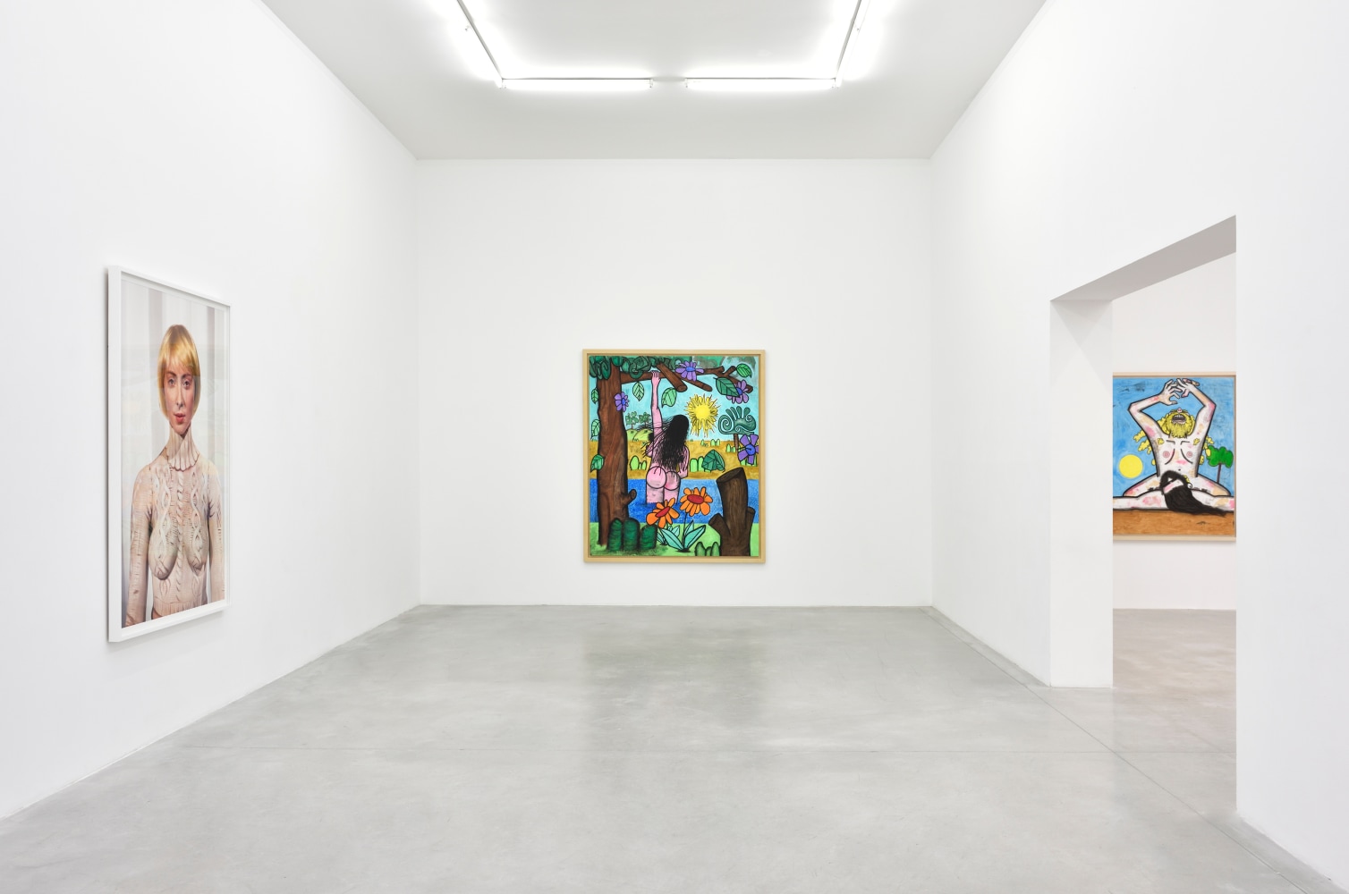 Installation view, Carroll Dunham &amp;amp; Laurie Simmons, Consortium Museum, Dijon, 2024